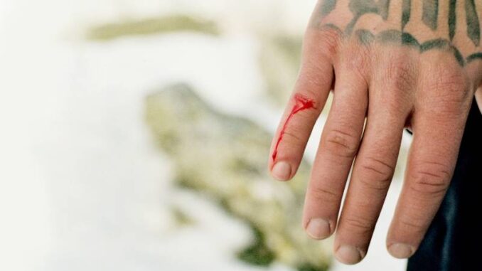 Blanco&nbsp;-&nbsp;Anche a vent&rsquo;anni si muore